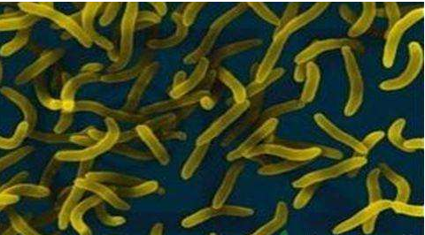 微生物菌劑好？好在哪里您知道嗎？